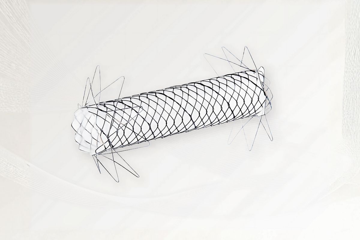 Stent AL - BONASTENT